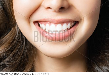 Perfect Healthy Teeth Smile Of A Young Woman. Teeth Whitening. Dental Clinic Patient. Image Symboliz