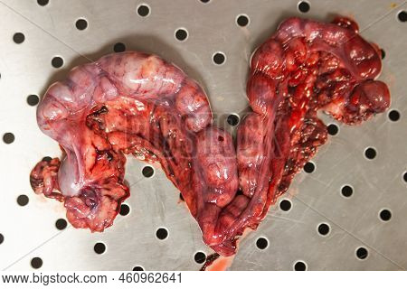 Top View Of Pyometra - Uterus Inflammation After Surgical Operation To Remove Uterus With Pus At The