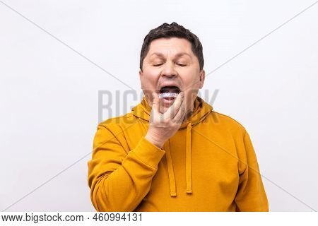 Middle Aged Man Placing A Bite Plate In His Mouth To Protect His Teeth At Night From Grinding Caused