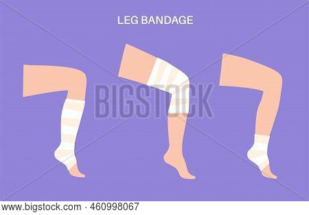 Elastic Bandage On Human Leg. Roll And Wrap Medical Gauze Over A Knee. Broken Or Injured Joint, Spra
