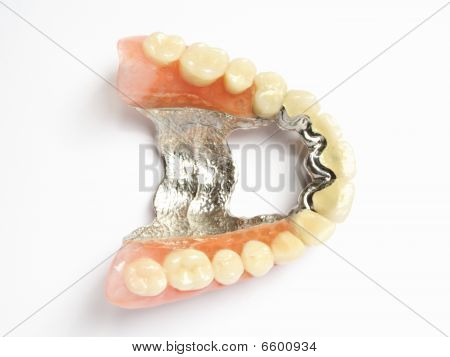 Künstliche Zähne auf weißem Hintergrund. Falsche Zähne (Zahnersatz, Krone, Brücke)