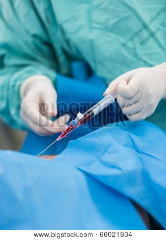 Central Venous Pressure