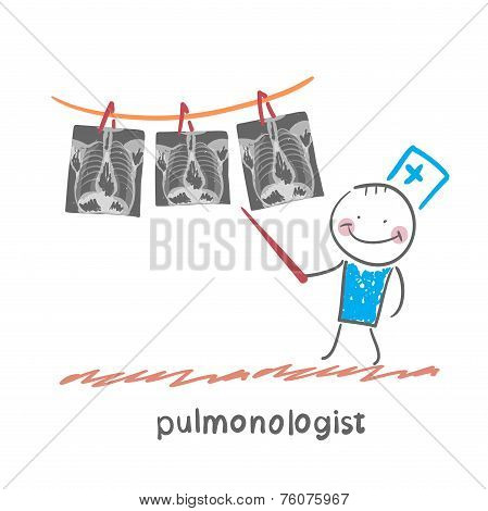pulmonologist shows an X-ray of human lung