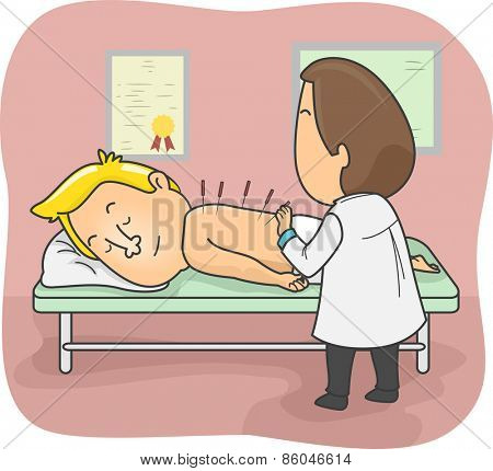 Illustration of an Acupuncture Sticking Acupuncture Needles on His Patient