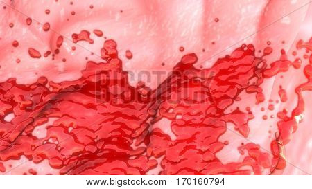 Heavy or prolonged menstrual periods, or menorrhagia, are the most common type of abnormal bleeding from the uterus.