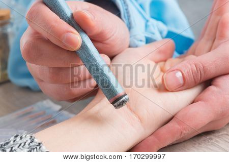 Alternative medicine therapist doing moxa treatment on her client