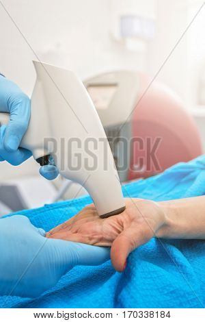 Procedure for palm against hyperhidrosis