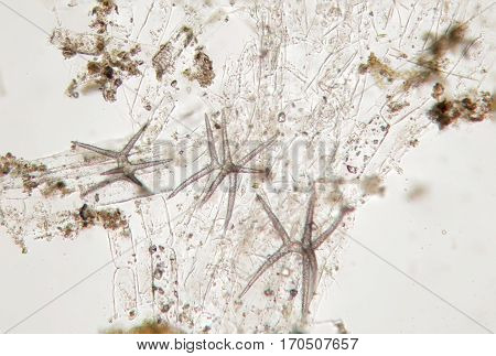 Microscopic life probably diatom algae. Freshwater phytoplankton by microscope. Super macro