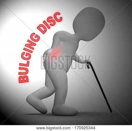 Bulging Disc Showing Back Chiropractor 3D Rendering