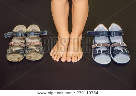 Old And New Childrens Orthopedic Shoes. Thomas Heel, Arch Support