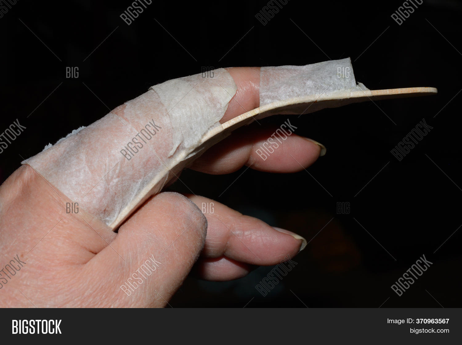 Homemade Finger Brace Image & Photo (Free Trial) Bigstock