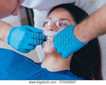 Installation Of The Expander, Preparation For The Photo Protocol