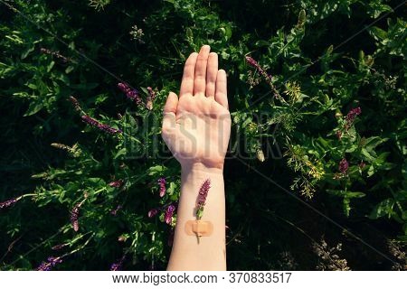 Flower Glued With Band-aid To Hand. Concept Of Mental Health, Medical Care For Different Types Of Me