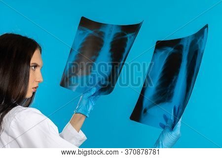 The Pulmonologist Checks The Patients Lungs For Any Disturbing Changes.