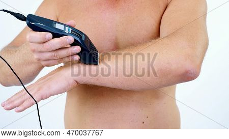 Close-up Of A Very Hairy Man Haircut Body Hair On His Whole Body, Hands By Himself With A Clipper, E