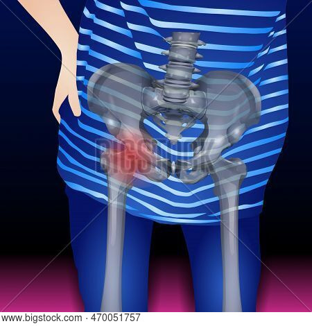 Human Urinary System Consists Of The Kidneys, Renal Pelvis, Ureter, Urinary Bladder, Urethra And Par