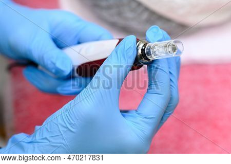 Preparation Of Dermapen For The Rejuvenation Procedure.