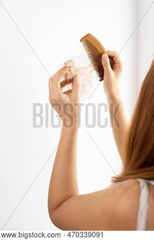 Hair Loss Problem, Postpartum Period, Menstrual Or Endocrine Disorders, Hormonal Imbalance, Stress C
