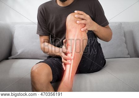 A Man With A Shinbone Fracture In An Accident.