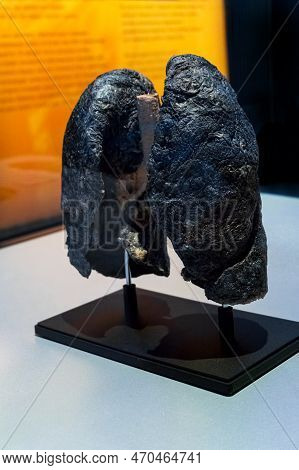 Moscow, Russia - May 05, 2021: Famous Anatomy Exhibition Body Worlds Where Plastinated Bodies Are Ex