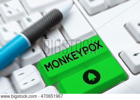 Hand Writing Sign Monkeypox. Business Showcase Poxvirus Of Africa Caused By Chiefly In Wild Rodents 