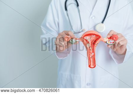 Doctor Holding Uterus And Ovaries Model. Ovarian And Cervical Cancer, Cervix Disorder, Endometriosis