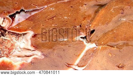 The Texture Of Beef Liver.fresh Raw Beef Liver Top View.beef Liver Background.beef Liver Top View.