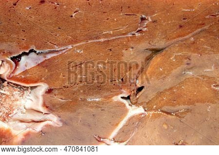 The Texture Of Beef Liver.fresh Raw Beef Liver Top View.beef Liver Background.beef Liver Top View.