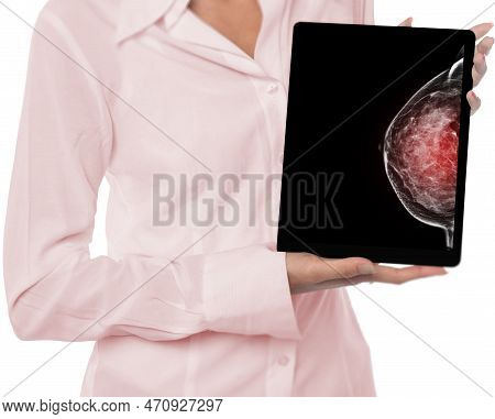 The Doctor Using Digital Tablet Against X-ray Digital Mammogram .