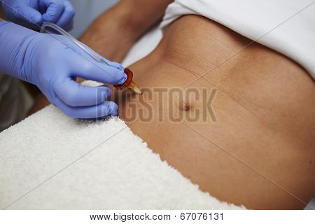 Beautiful belly abdomen mesotherapy gun therapy
