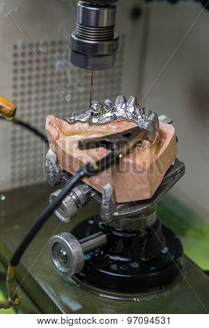 Edm Machine For Denture