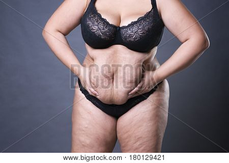 Woman with fat abdomen overweight female stomach stretch marks on belly closeup gray studio background