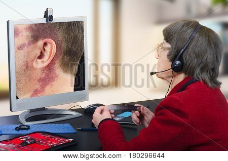 Telemedicine female dermatologist in headset observes at birthmark on computer monitor attentively. Virtual doctor looks at man having a big red birthmark on his face and neck either by online video chat or snapshot. Horizontal mid-shot on blurry indoors