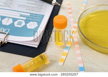 Containers With Urine Sample For Analysis, Litmus Paper And Medical Report On Table In Laboratory