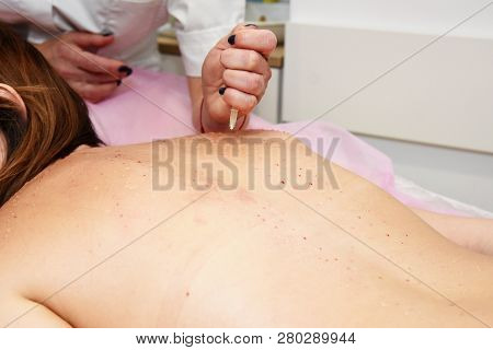 Beauty Injections In The Salon. The Procedure For Skin Tightening And Rejuvenation.