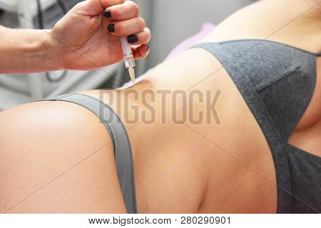 Beauty Injections In The Salon. The Procedure For Skin Tightening And Rejuvenation.