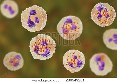 Bacteria Neisseria Gonorrhoeae Inside Neutrophils, Gonoccoccus, Diplococci That Cause Sexually Trans