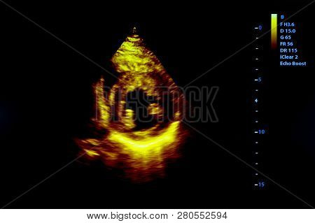 Colourful Image Of Modern Ultrasound Monitor. Ultrasonography Machine. High Technology Medical And H