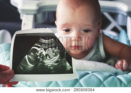 Ultrasound Image At The 20th Week Of Pregnancy In The Foreground. In The Background Is A 6 Month Old