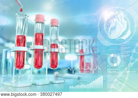 Test Tubes In Chemistry Clinic - Blood Sample Test For Fasting Blood Sugar Or Cholesterol, Medical 3
