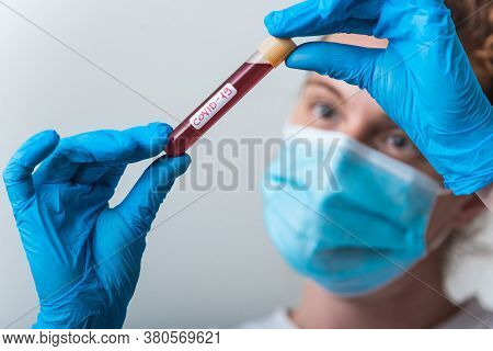 Tube Of Blood And Blood Serum In The Hands Of The Scientist Or Laboratory For Analysis And Research 