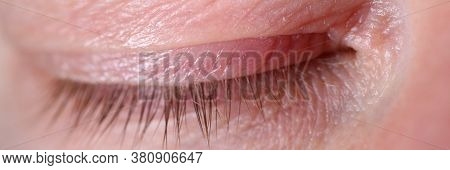 Close-up Of Middle-aged Man Closed Eye. Macro Shot Of Tiny Wrinkles On Senior Male Skin. Cant See An