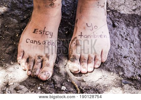 Pair Of Tired Feet