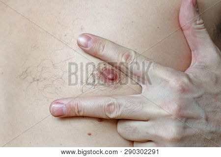 Male Hairy Nipple. Nipple With Hair. Easy Erotica And Humor. Without Epilation. Male Hand. Bdsm