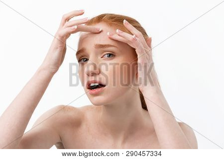 Young Caucsian Woman Squeezes Acne On The Face Of Beauty