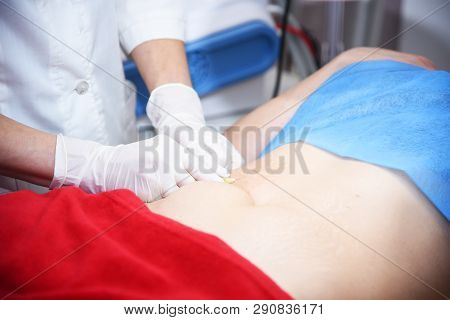 Plasmolifting. Injections For Rejuvenation And Skin Regurgitation From Human Plasma. A Modern Beauty
