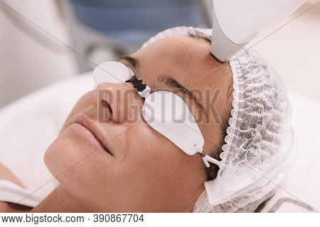Cropped Close Up Of A Mature Woman Smiling, Getting Facial Hair Removed With Laser At Beauty Clinic.
