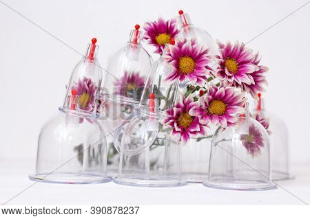 Jars For Hijama On A White Wooden Background And Pink Harezantems. Bloodletting. Sunnah Treatment. I