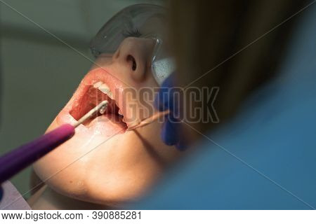 Close-up Portrait Of A Female Patient At Dentist In The Clinic. Beautiful Girl In Dental Chair On Th