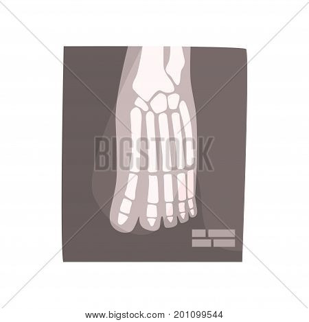 X ray image of human foot cartoon vector Illustration on a white background